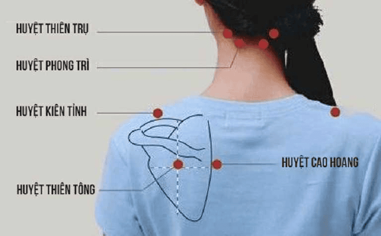 Phương pháp điều trị thoái hóa đốt sống cổ bằng bấm huyệt
