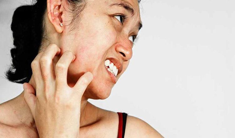 Kích ứng da, khô da là tác dụng phụ của thuốc beprosalic lotion