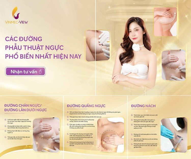 Phẫu thuật nâng ngực bằng đường nào tốt nhất hiện nay?