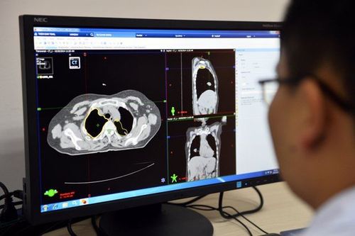 Khám, tư vấn miễn phí về ung thư với chuyên gia Singapore tại Vinmec