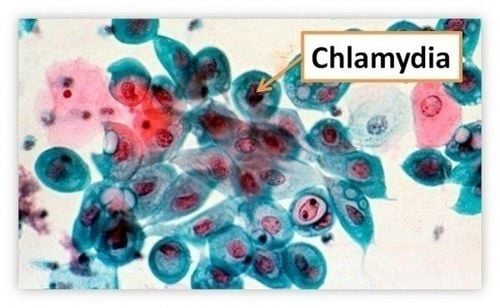 Chlamydia bacteria