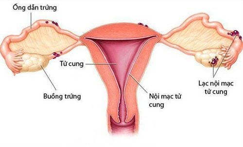 Location of the Endometrial Lining
