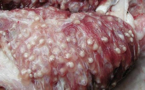Pork infected with tapeworms often has white spots