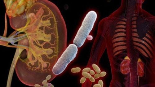 
Tai biến sau thủ thuật có thể xảy ra như nhiễm trùng tiết niệu
