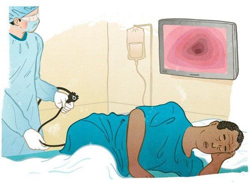 Nội soi đại tràng giúp chẩn đoán bệnh Crohn được chính xác hơn