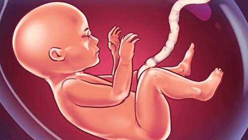 What Does Yellowish or Moss-Green Amniotic Fluid Indicate? 