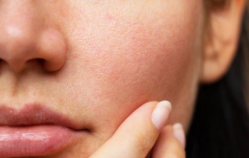 Cách khắc phục, hạn chế lỗ chân lông to trên mặt