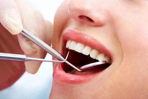 Lây cao răng thường xuyên giúp ngăn ngừa chảy máu chân răng