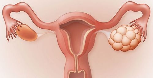 Although most polyps are benign, some cases may present risks of complications, making women question whether cervical polyps are dangerous.

