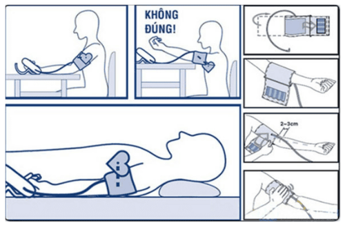 Nghiệm pháp bàn nghiêng trong chẩn đoán hạ huyết áp tư thế