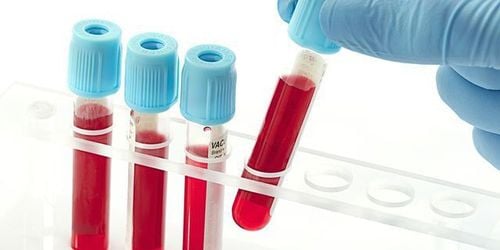 Leukopenia is detected through blood tests