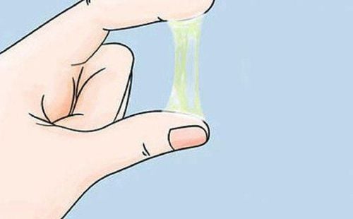 Vaginal discharge increases before menstruation is simply a sign that your period is coming