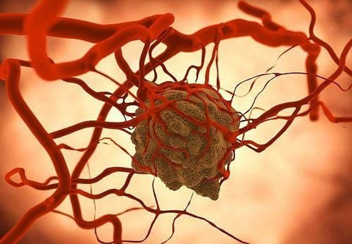 Heat makes cancer stem cells sensitive to radiation