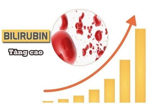 High bilirubin levels