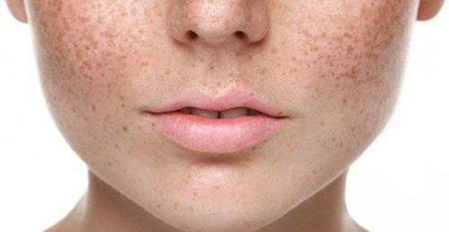 Các vấn đề về da thường gặp ở người lớn: Bệnh zona, nổi mề đay và hơn thế nữa