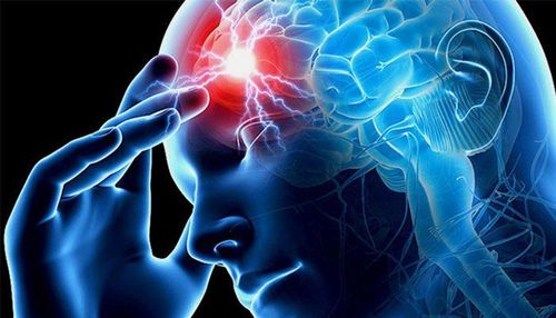 80% các trường hợp đột quỵ có thể phòng ngừa