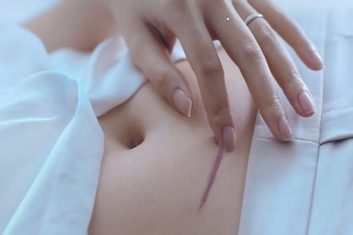 Slide item