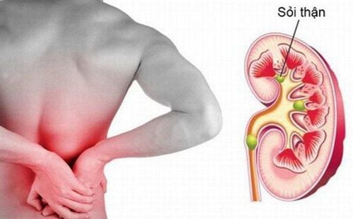 Taking medication or having surgery for 6-7mm kidney stones?
