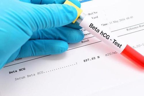 Non-pregnant individuals have an hCG level of under 5 mIU/ml while pregnant individuals will have 25 mIU/ml or above.