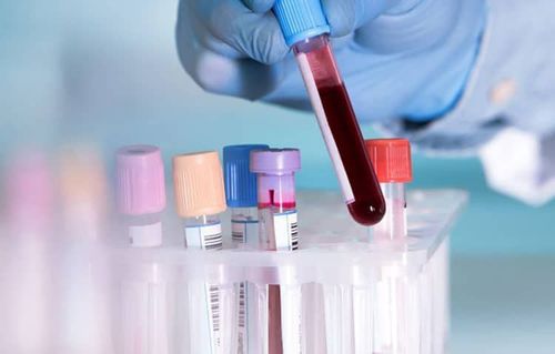 Different addictive drugs will have different half-lives in the body.
