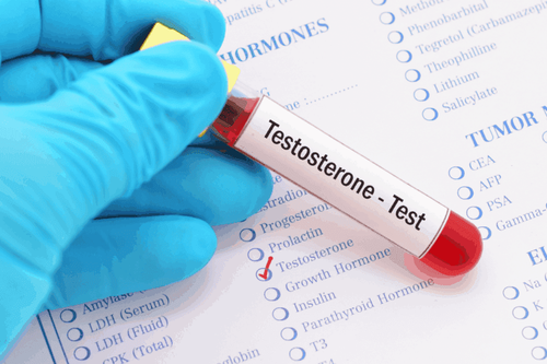 In certain cases, ensuring optimal testosterone levels is necessary to help you achieve better orgasms.