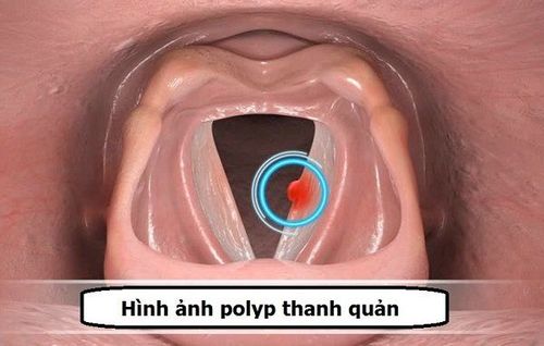 Throat Examination Aids in Detecting Serious Throat Conditions
