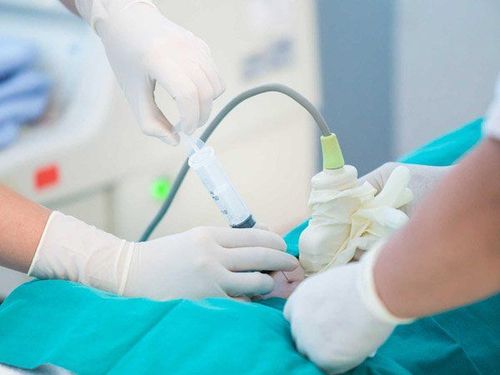 Chọc ối là gì: Mục đích, Quy trình, Rủi ro & Hồi phục an toàn