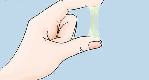 Tình trạng viêm càng nặng, khí hư ra càng nhiều và càng nặng mùi hơn