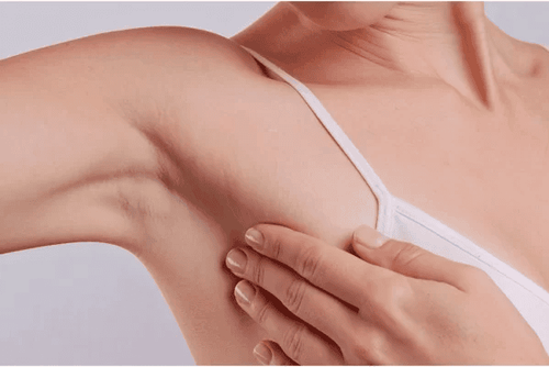 After giving birth, is it necessary to see a doctor for a lump in the armpit?