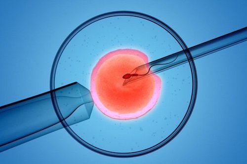 Thụ tinh trong ống nghiệm IVF