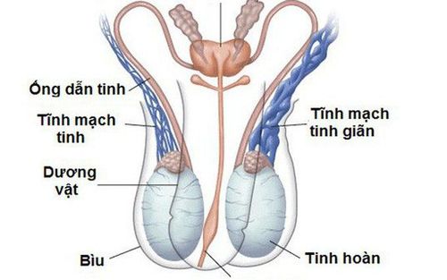 Giãn tĩnh mạch thừng tinh ở nam giới