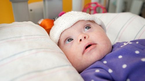 Diagnosis and treatment of acute pulmonary edema