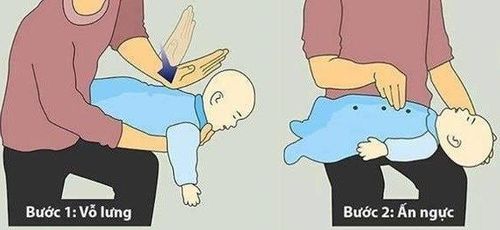 Xử trí khi trẻ sặc bột, cháo