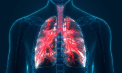 Bệnh phổi tắc nghẽn mãn tính