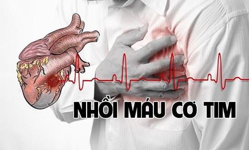 Cầu nối động mạch vành (CNĐMV) cấp cứu được chỉ định ở bệnh nhân nhồi máu cơ tim có ST chênh hay không chênh