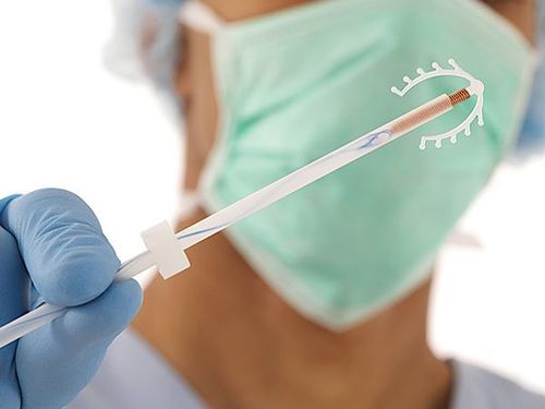 
Đặt vòng tránh thai là phương pháp ngừa thai hiệu quả và an toàn
