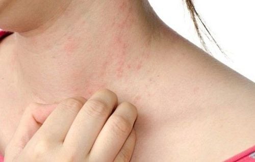 Although some studies have not definitively established a connection between MSG and these symptoms, some sensitive individuals may experience short-term reactions to MSG.
