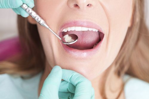 Vi khuẩn trong miệng sinh sôi, ảnh hưởng thế nào tới sức khỏe cơ thể bạn?