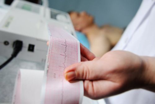 Người bệnh rối loạn nhịp tim thuộc nhóm có nguy cơ cao biến chứng nhồi máu cơ tim