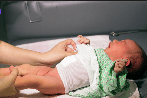 After bathing and cleaning the baby, mothers should immediately change the baby's umbilical bandage.