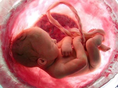 Normally an umbilical cord has two umbilical arteries.