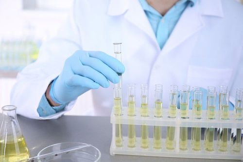 Xét nghiệm bằng mẫu nước tiểu