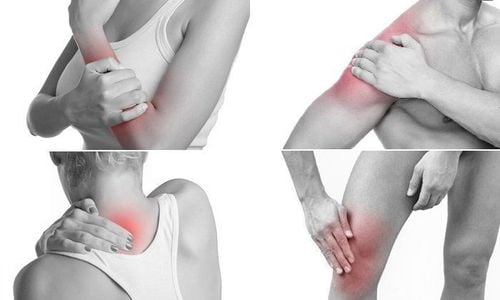 Muscle spasms cause the pain