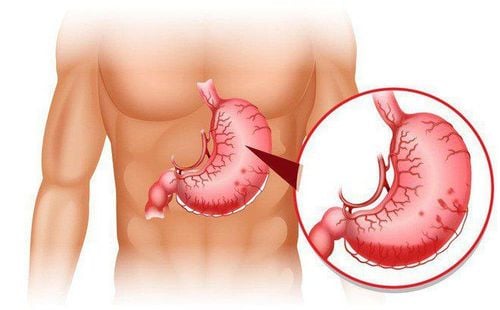 Endoscopic Images of Gastritis and Normal Stomach