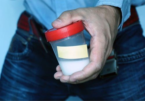 Mẫu tinh trùng được lấy bằng cách thủ dâm