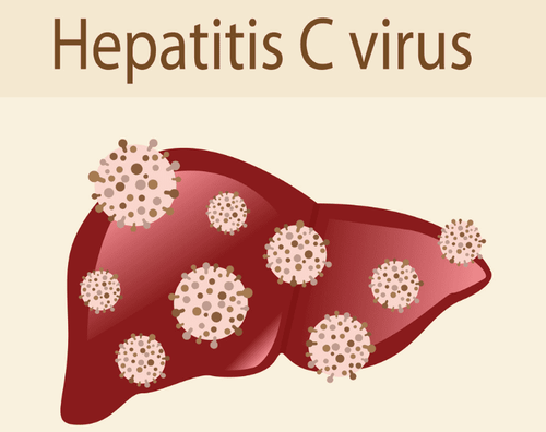 
Virus viêm gan C tấn công gan khiến cơ thể người bệnh bị nhiễm trùng

