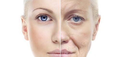 Skin Aging Due to Vitamin C Deficiency