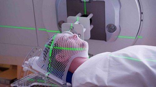 Xạ trị đầu cổ có thể dẫn đến chảy máu tuyến yên