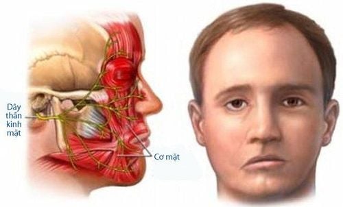 Bệnh co thắt cơ nửa mặt