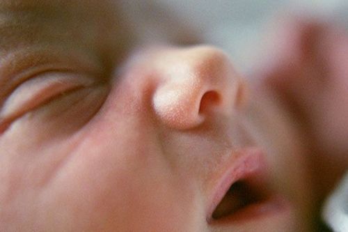 Viêm kết mạc là bệnh xảy ra chủ yếu ở trẻ sơ sinh do nhiễm virus, vi khuẩn